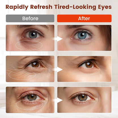 Red Light Therapy for Eyes, Comfort under Eye Red Light Therapy